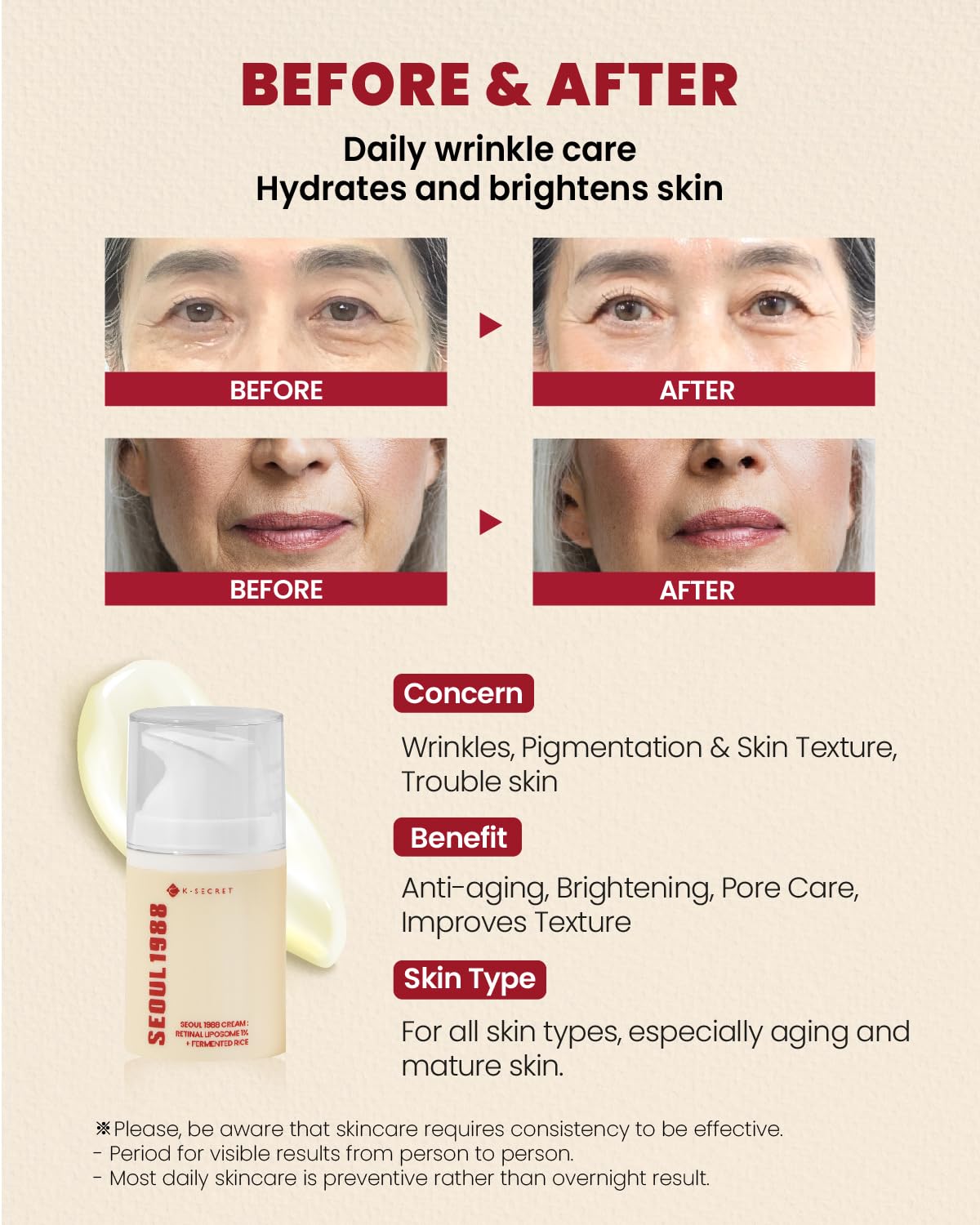 SEOUL 1988 RETINAL CREAM