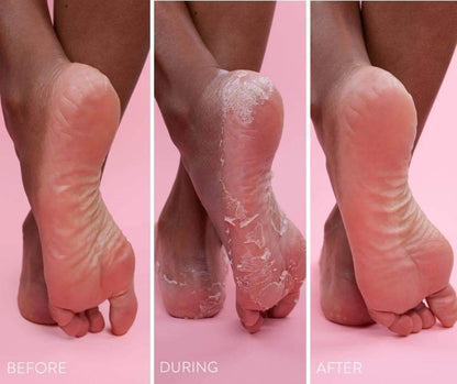 FOOT EXFOLIATING PEELING MASK